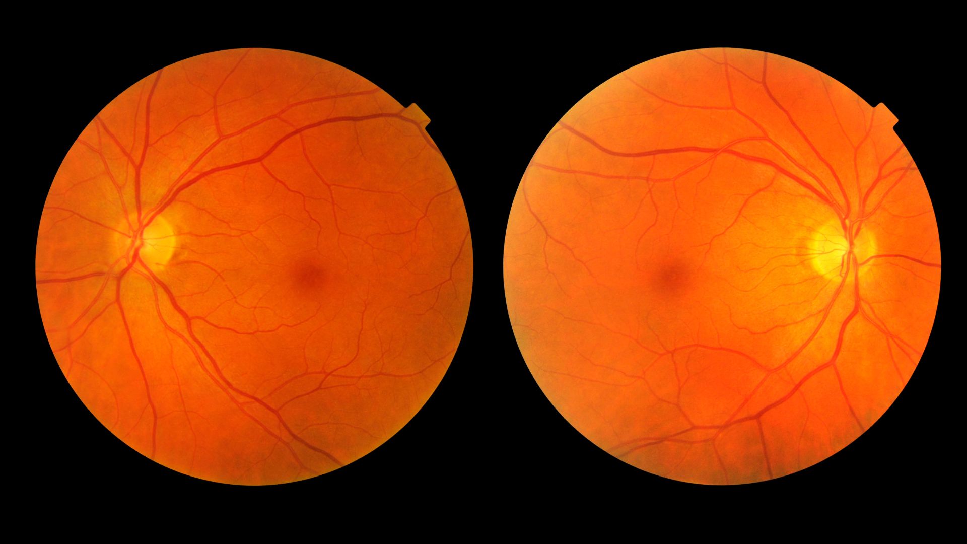 Color fundus photographs of the retina
