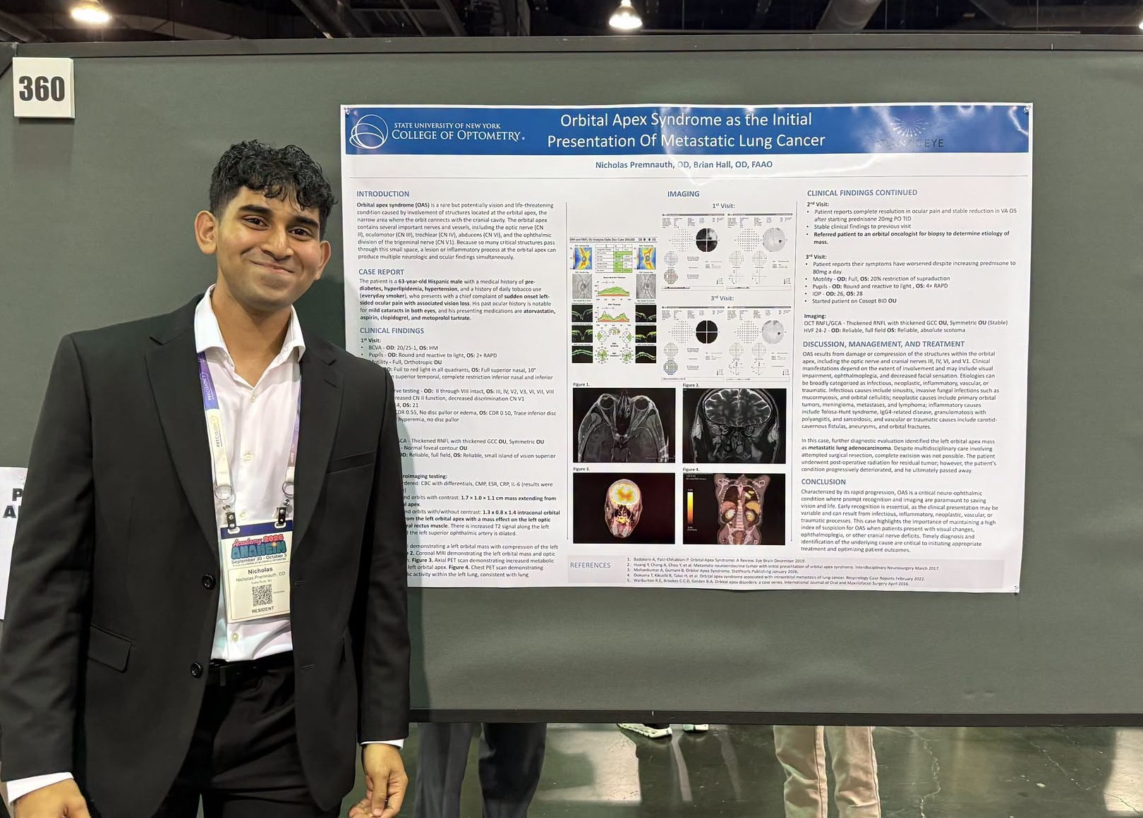 Nicholas Premnauth, OD with his and Brian Hall's, OD, FAAO poster titled, 'Orbital Apex Syndrome as the initial presentation of metastatic lung cancer