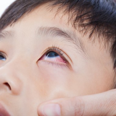 Closeup of child's eye with pink eye